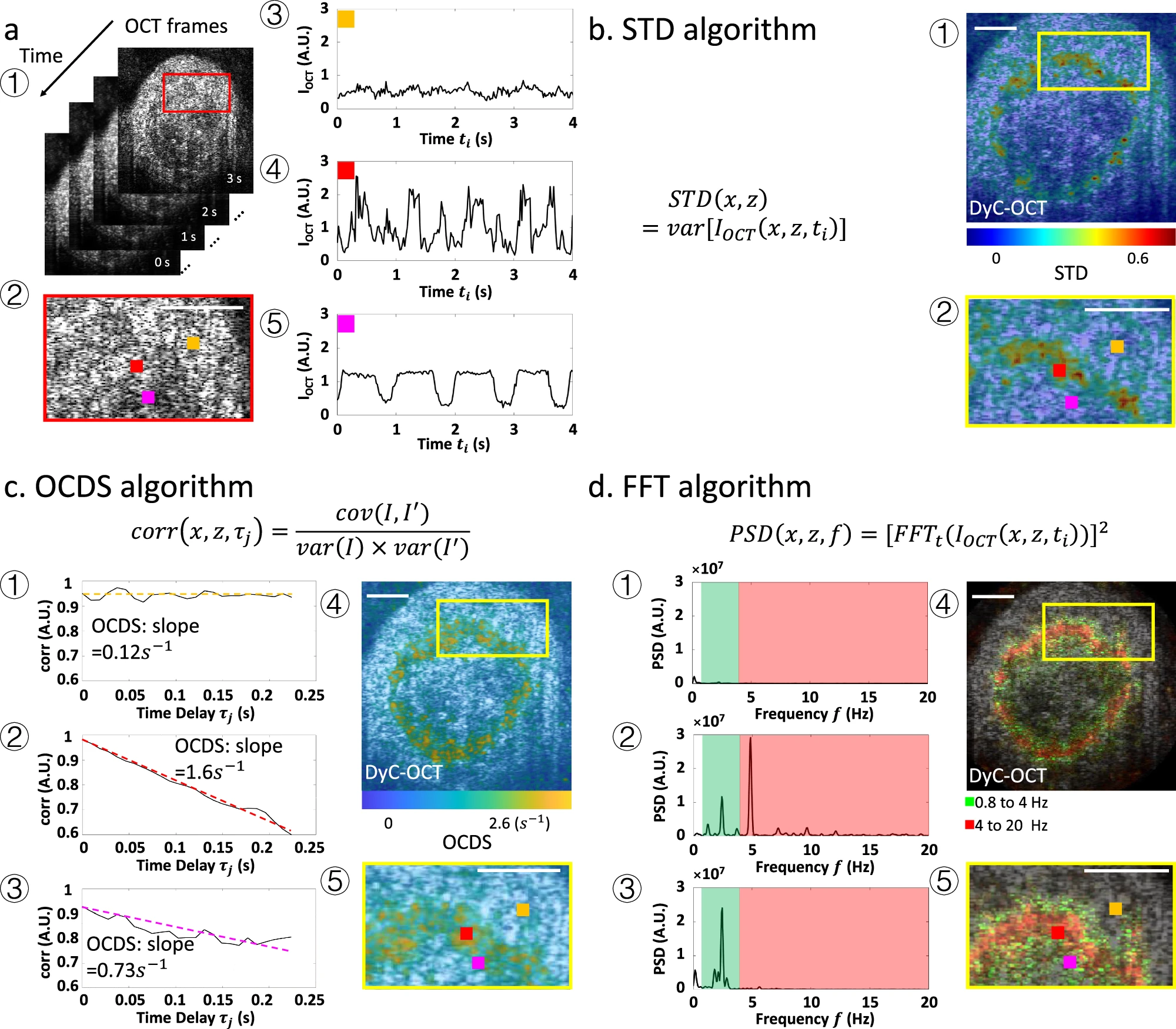 Image for Dynamic contrast optical coherence tomography (DyC-OCT) for label-free live cell imaging